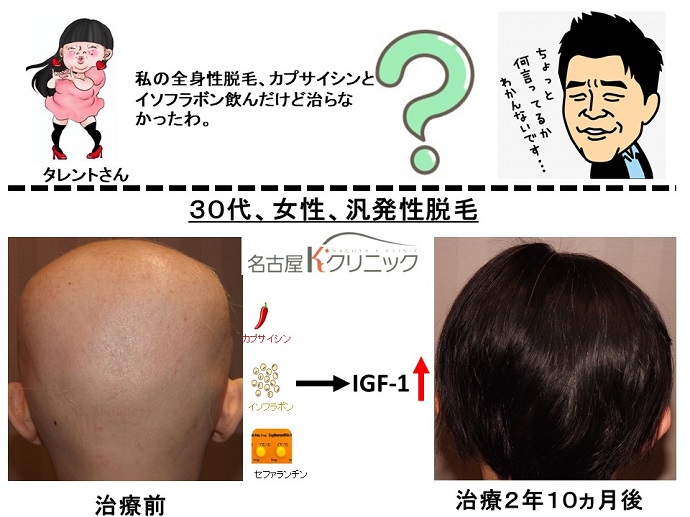 円形脱毛症　病院